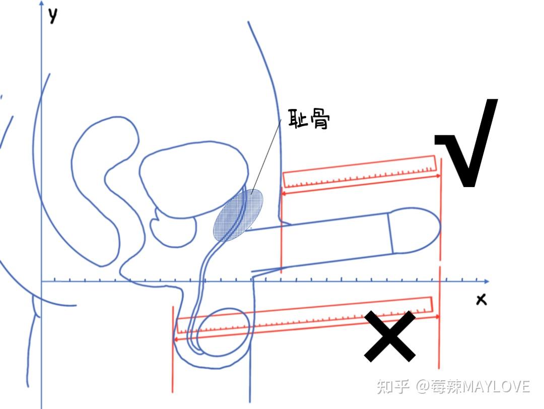 男生的小丁丁,到底长什么样?(高清彩图)