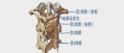 环枢关节错位——怪病之根源