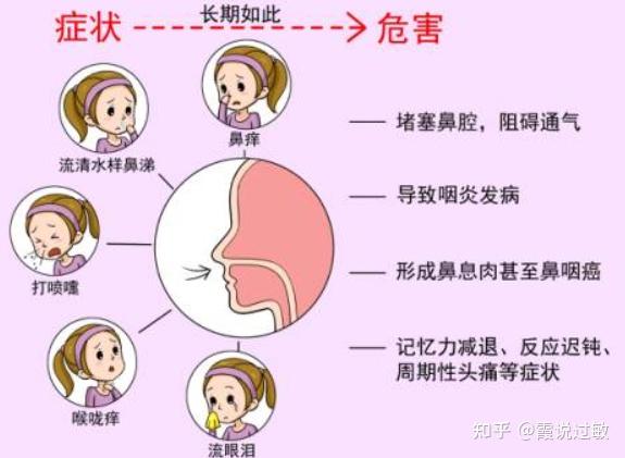 过敏性鼻炎与感冒傻傻分不清楚