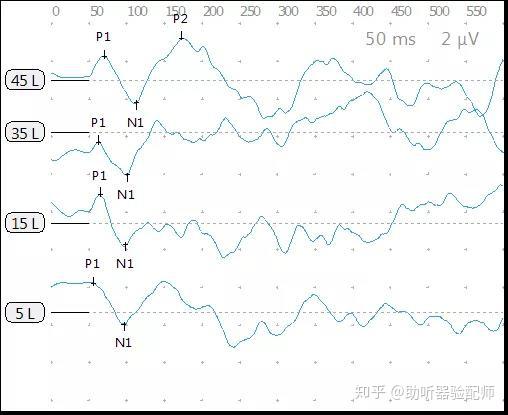 皮层听觉诱发电位(cortical auditory evoked potential,caep)也是一