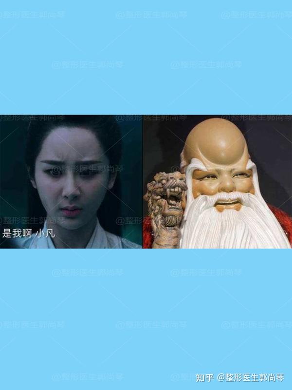 千万不要贪心,填充的时候要注意额头与眉骨的衔接,少量多次,别成寿星