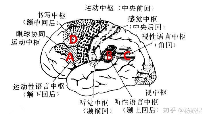 性语言中枢(a,听觉性语言中枢(b,视觉性语言中枢(c,和书写中枢(d)
