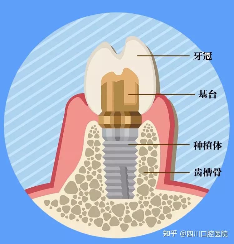 高标准种植牙层流手术室到底啥样?