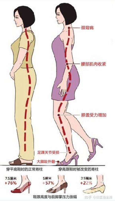 穿高跟鞋时的正确走路姿势是怎样的?