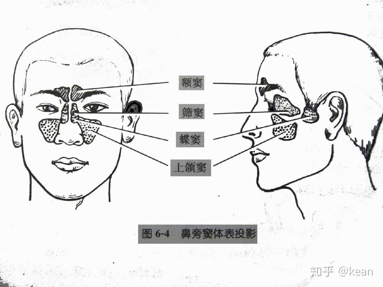 声带小结或者蝶窦唱法是导致mariahcarey世纪大倒嗓的直观原因吗
