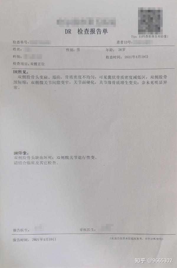 双髋正位dr检查报告单