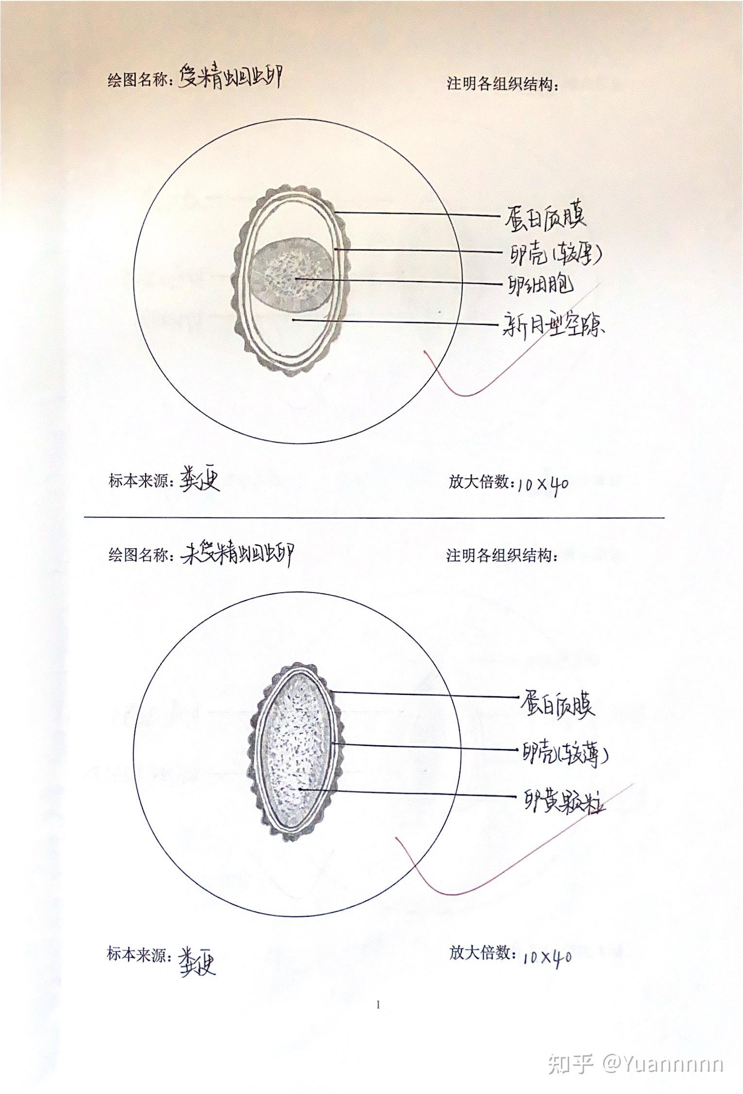 人体寄生虫学手绘图及组织结构标注分享参考