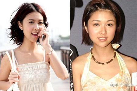王者增发掉发,改变和防止女生线?发际荣耀图片变态图片