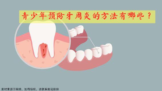 青少年预防牙周炎的方法有哪些?