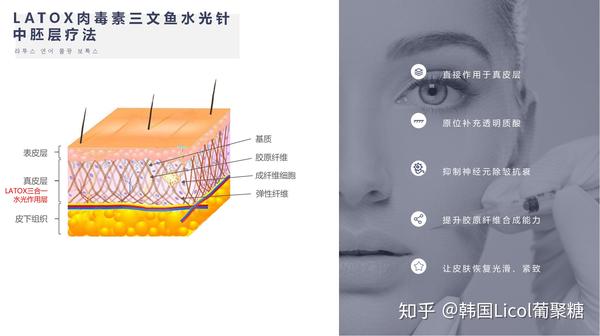 韩国首款latox肉毒素三文鱼水光针剂