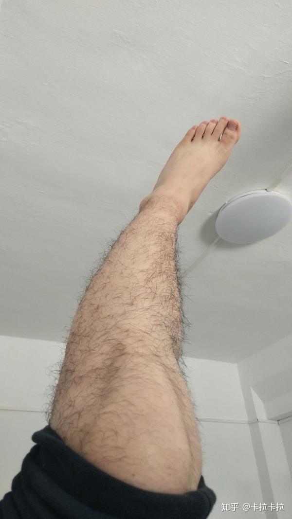 男生腿毛浓密怎么办?