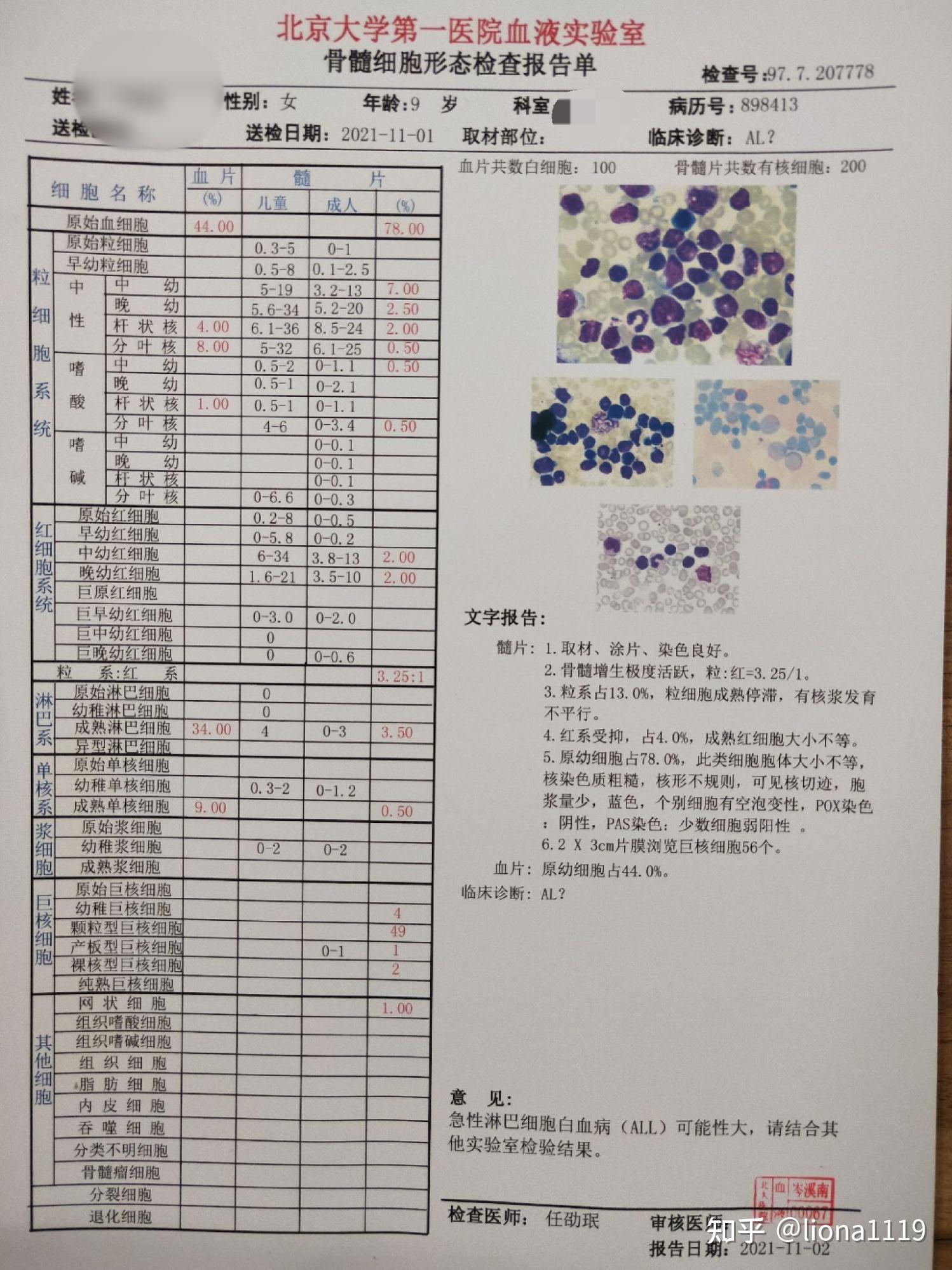 对了,费用,住院押金1万,当天骨穿报告是送检第三方公司(道培),好像是