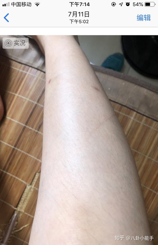 可能是因为刚擦完身体乳的原因,我觉得腿看起来好很多了(ps:身体乳最