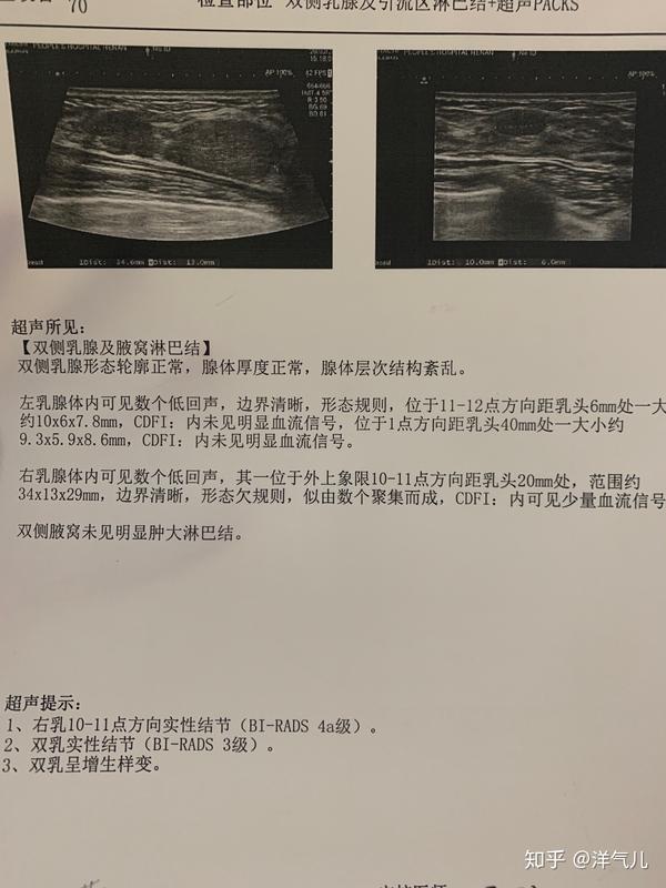 23岁乳腺纤维瘤3级做手术前一天