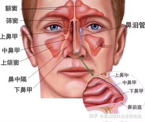 深圳友谊医院耳鼻喉科-鼻窦炎的护理方法