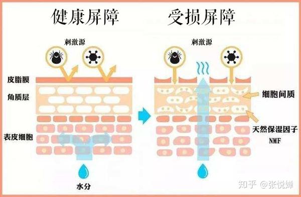 如果你的皮肤屏障已经受损了,针对这样的情况你再去做基础的保湿也就