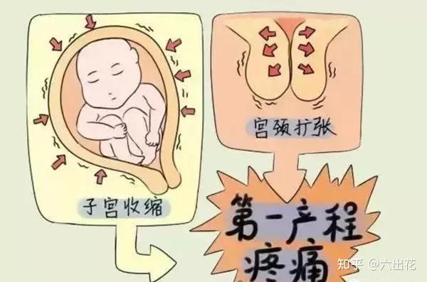 羊水破了宫口不开是怎么回事?