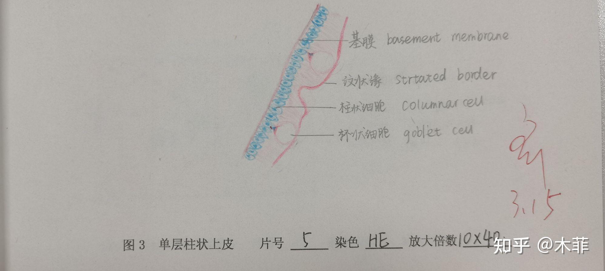 单层柱状上皮20级预防医学在读,无绘画基础,单纯分享课堂日常(因为