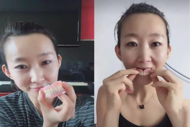 黑龙江一美女14岁患牙周炎36岁牙齿掉光看看她经历了什么