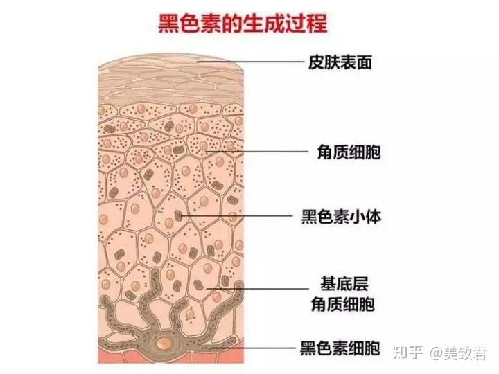 激光治疗后反黑在医学上被称为"炎症后色素沉着".