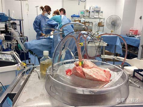 如何评价中国医生完成全球首例无缺血心脏移植?这意味着什么?