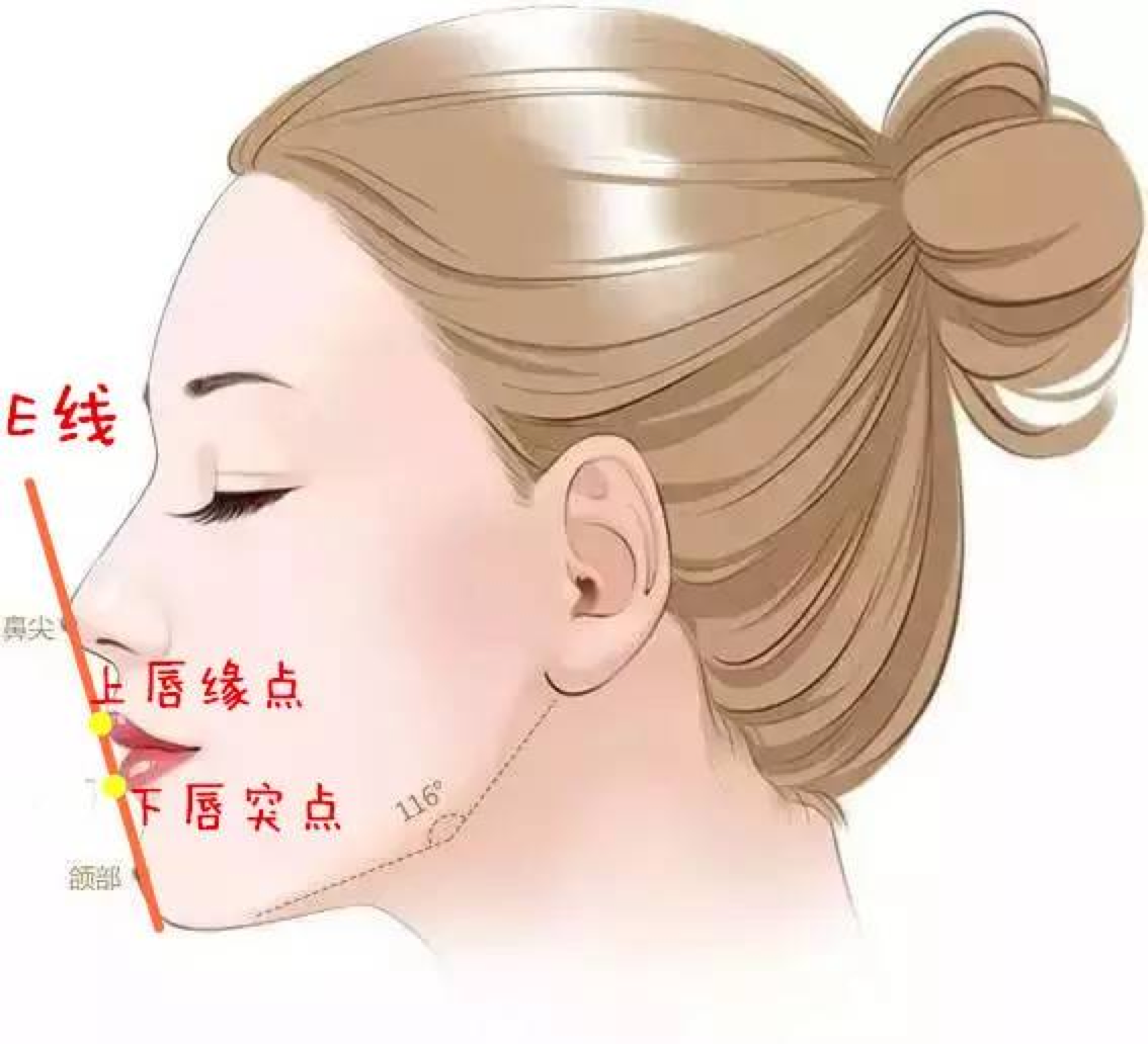 如何科学改善凸嘴下巴后缩,双下巴?