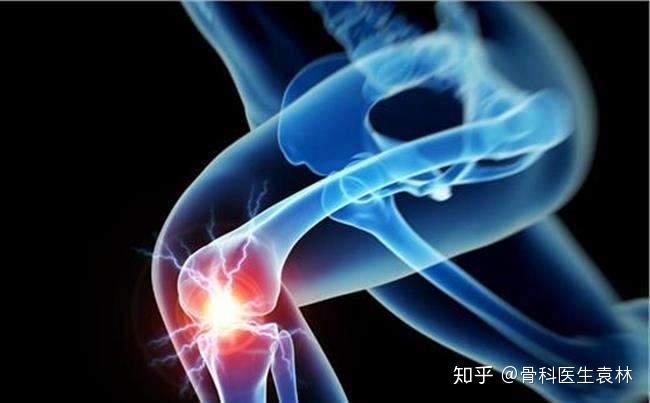 膝关节骨质增生是怎么形成的?如何治疗?