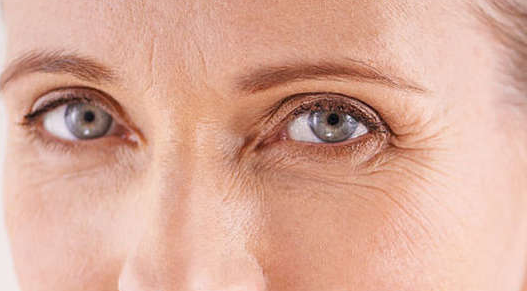 眼部的皱纹越来越多,该怎么去淡化呢?