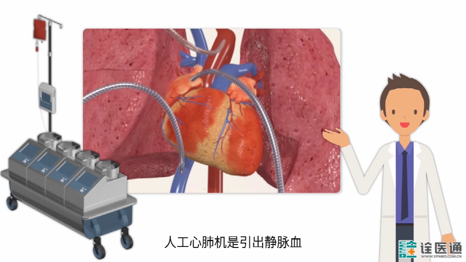 3d动画带您了解心脏室间隔缺损手术的全过程