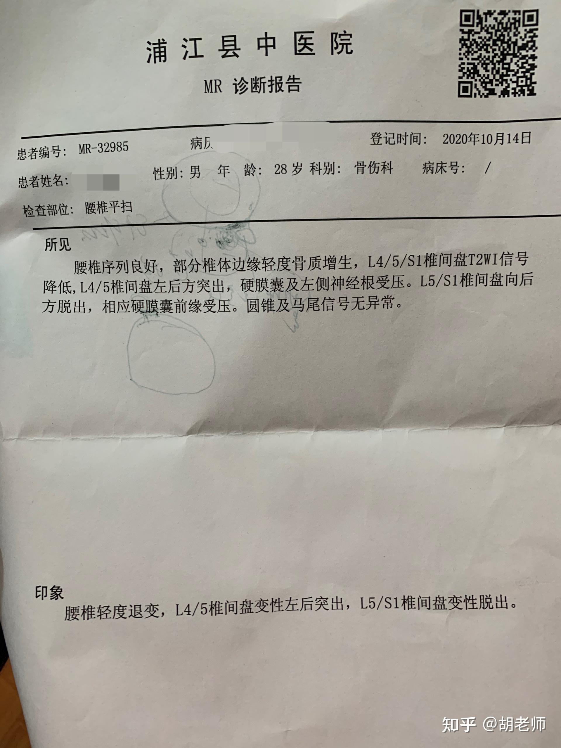 记录我的腰间盘突出脱出历程持续更新