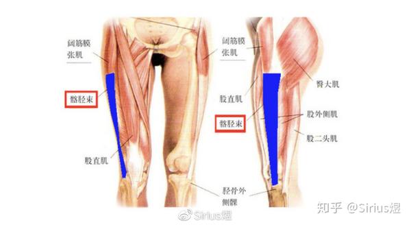 髂胫束和膝盖外侧的外上髁结构反复摩擦,久而久之导致出现无菌性炎症