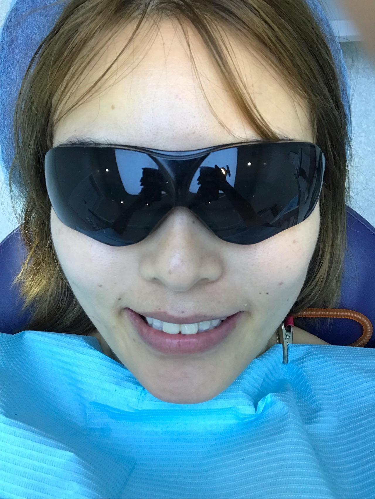 激光美白效果好吗 知乎