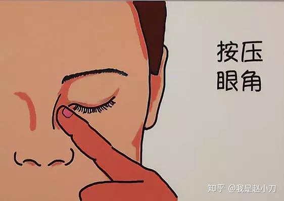 不要揉眼,同时用一个手指轻按住靠近鼻侧的眼角,以防药液顺着鼻泪管