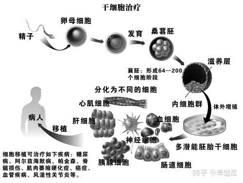 水剥离干细胞作用详解