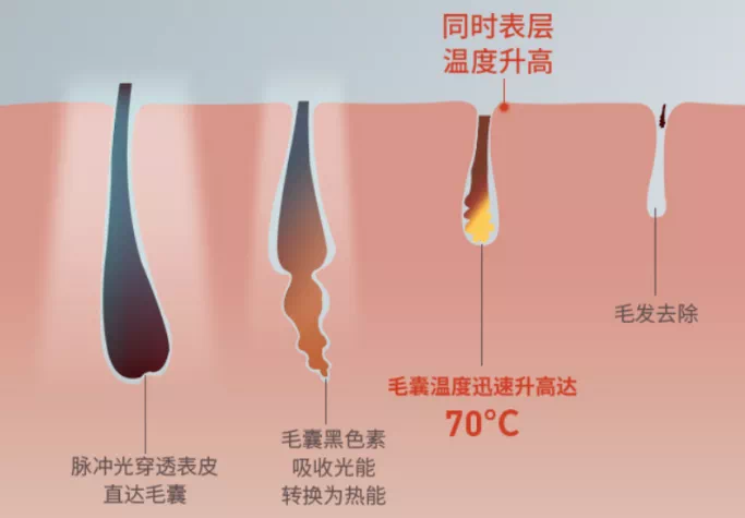 飞利浦家用激光脱毛仪女士专用bri956全身私处腋下比基尼剃毛仪器淘宝