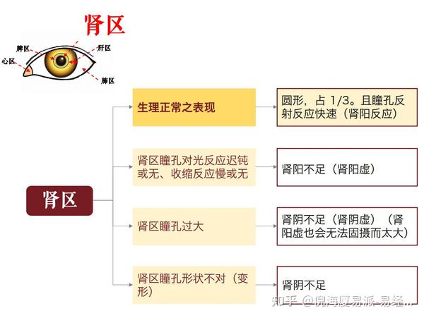 倪海厦传承中医的眼诊法|虹膜判断身体健康,如何通过眼镜判断身体是否