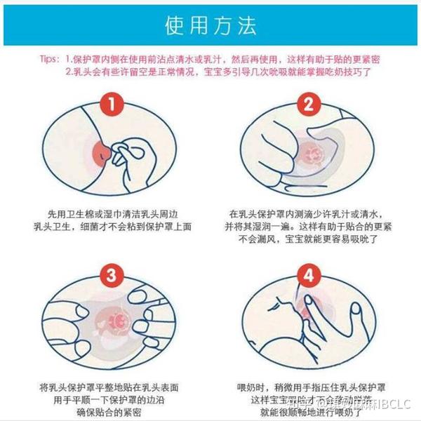 乳头扁平凹陷可以正常哺乳吗