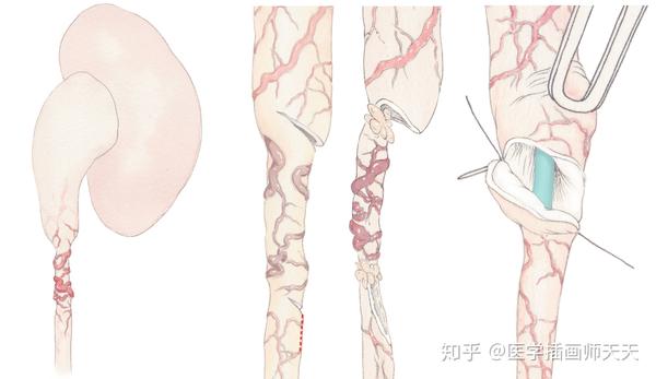 医学插画师成长系列3一路坚守的耳鼻喉科退役选手