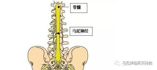 马尾神经是指在脊髓圆锥以下的腰骶神经根称为马尾神经,马尾由l2-5,s1