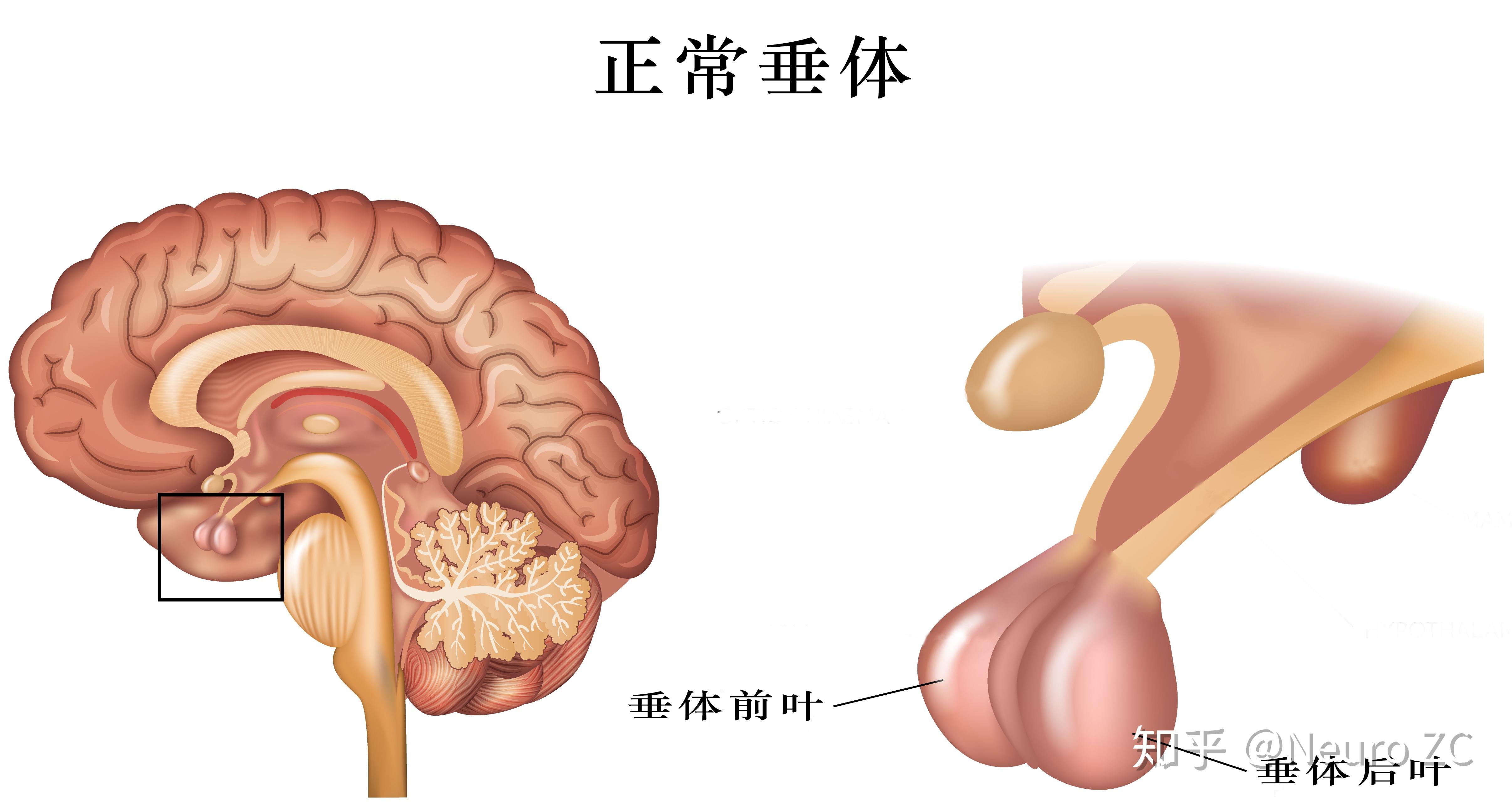 症状取决于您所患垂体腺瘤的类型及其大小.