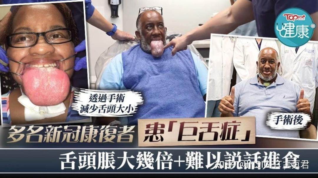 如果想要恢复到正常的吃饭和说话,只能给部分舌头做切除术.想想就疼.