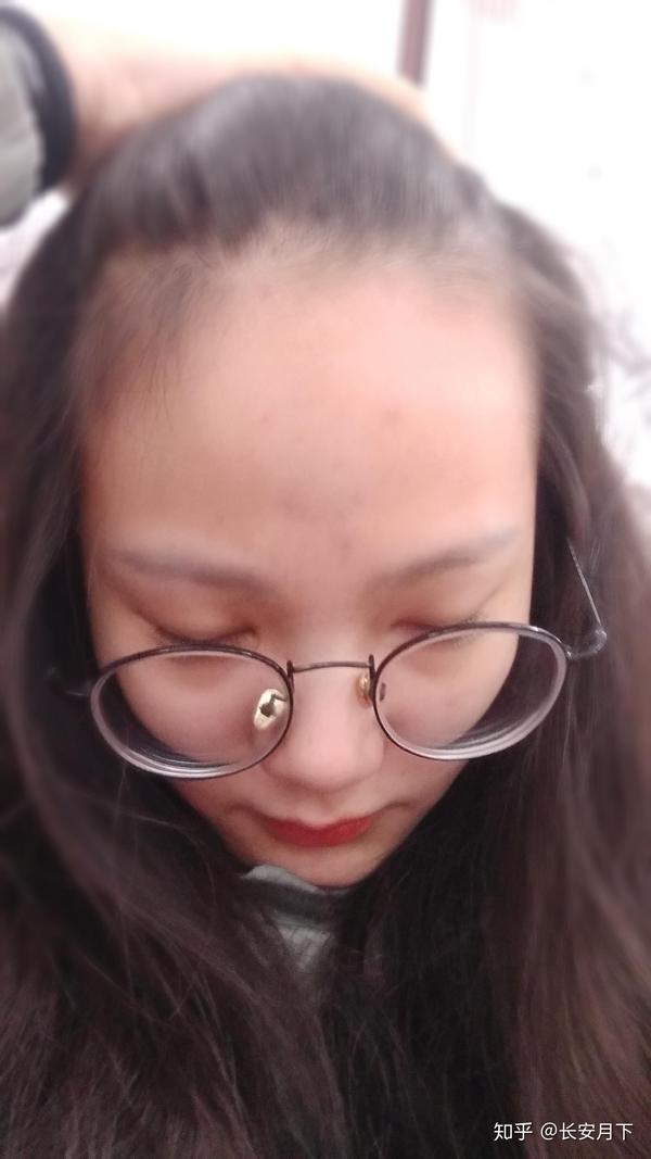 长圆脸,大额头且高,咬肌大的女生适合什么样的发型?