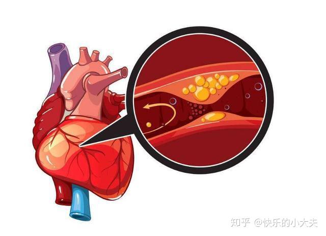 心梗来时怎么做才能更好的救人?日常养成6个习惯保障心脏安全