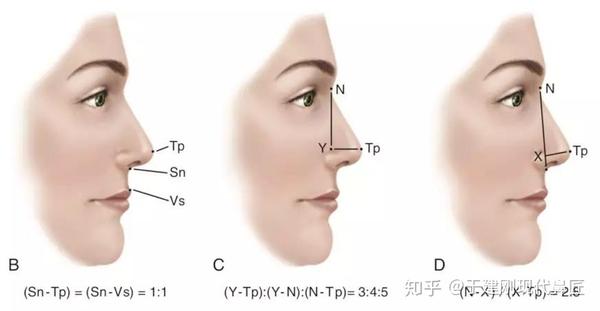 鼻尖也被称为"鼻头",位于面部正面观和侧面观最突出的部位,是极其