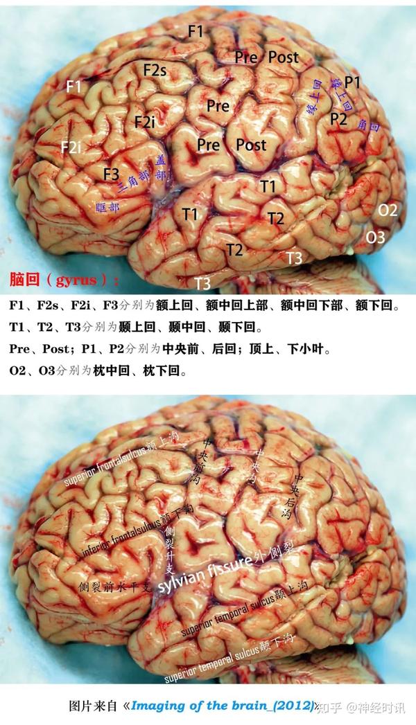 临床笔记一文带你认清端脑的沟沟壑壑