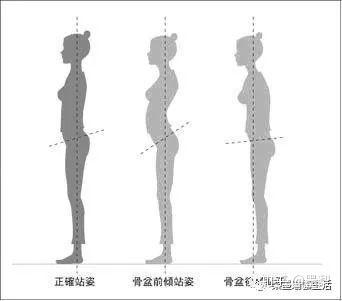 如何缓解腰肌劳损