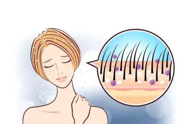 头皮长了小疙瘩别忽视,可能是疾病的预兆