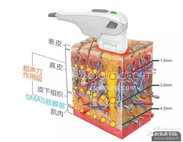 软组织之脂肪层衰老