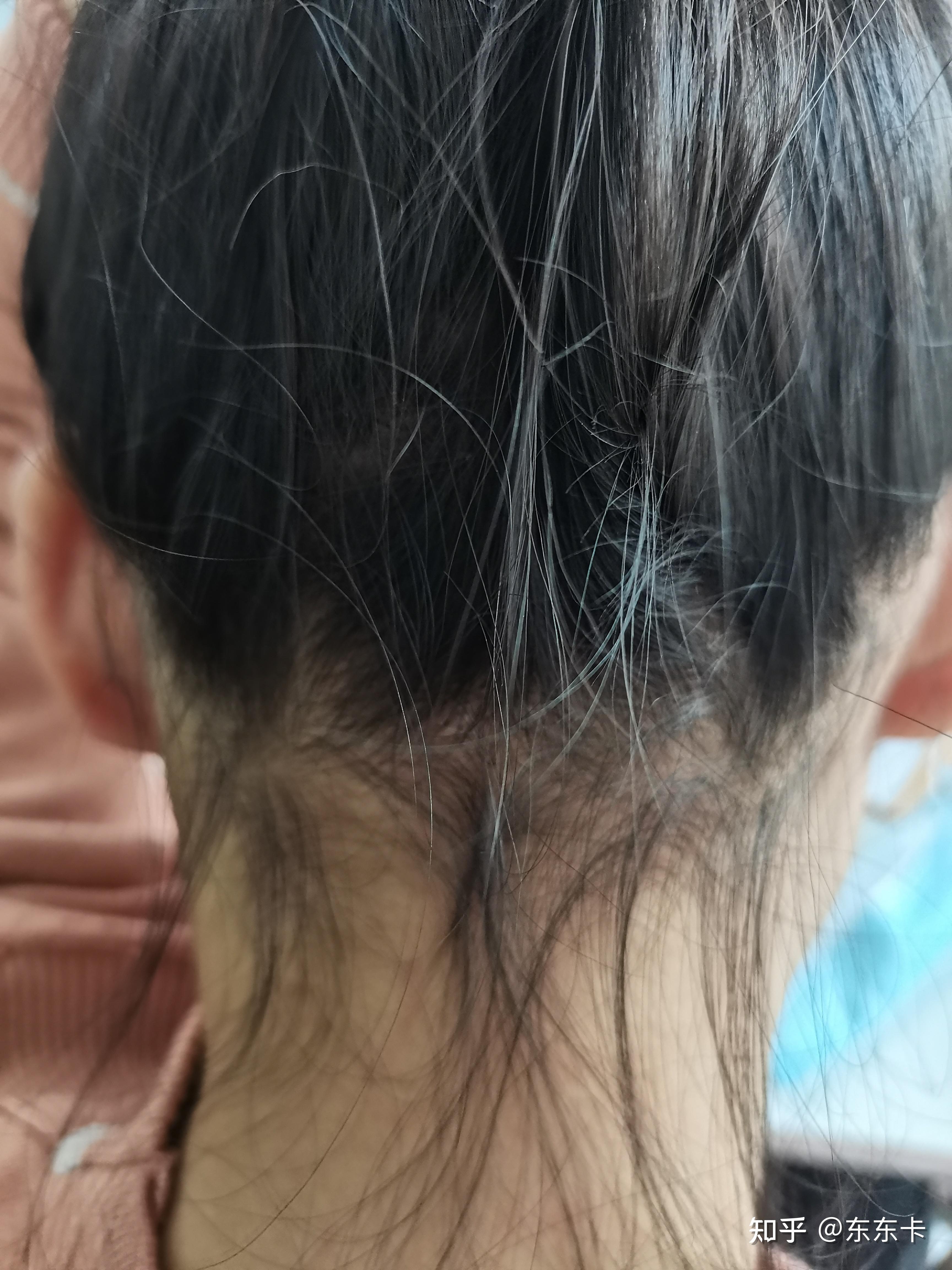 头发后面一堆碎发什么鬼