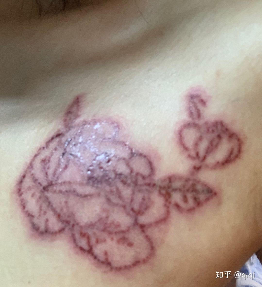 记录我的第一次洗纹身希望我的经历可以帮到大家
